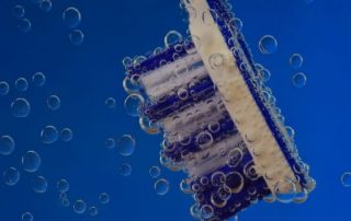 Gum Infection - Oral Health